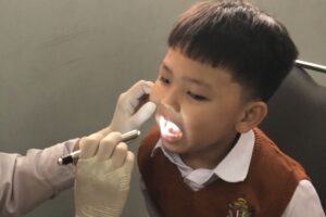 CKG Perkuat Kesehatan Berkualitas lewat Deteksi Dini Gigi Berlubang Anak